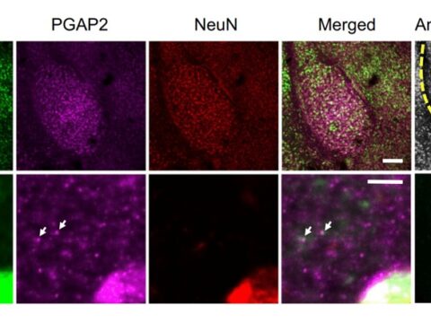 Amsbio: Exploring the role of microRNAs in the mechanism of stress-induced anxiety