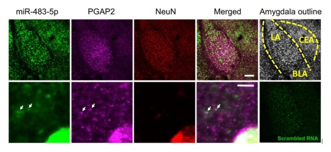 Amsbio: Exploring the role of microRNAs in the mechanism of stress-induced anxiety