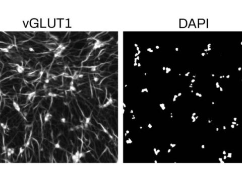 Amsbio: Quick differentiation kits for iPSC derived neurons