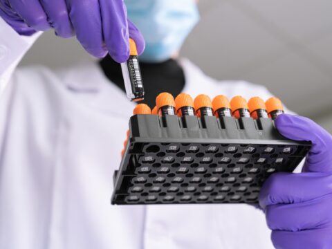 Azenta: tubos de almacenamiento de muestras con garantía de esterilidad mediante haz de electrones