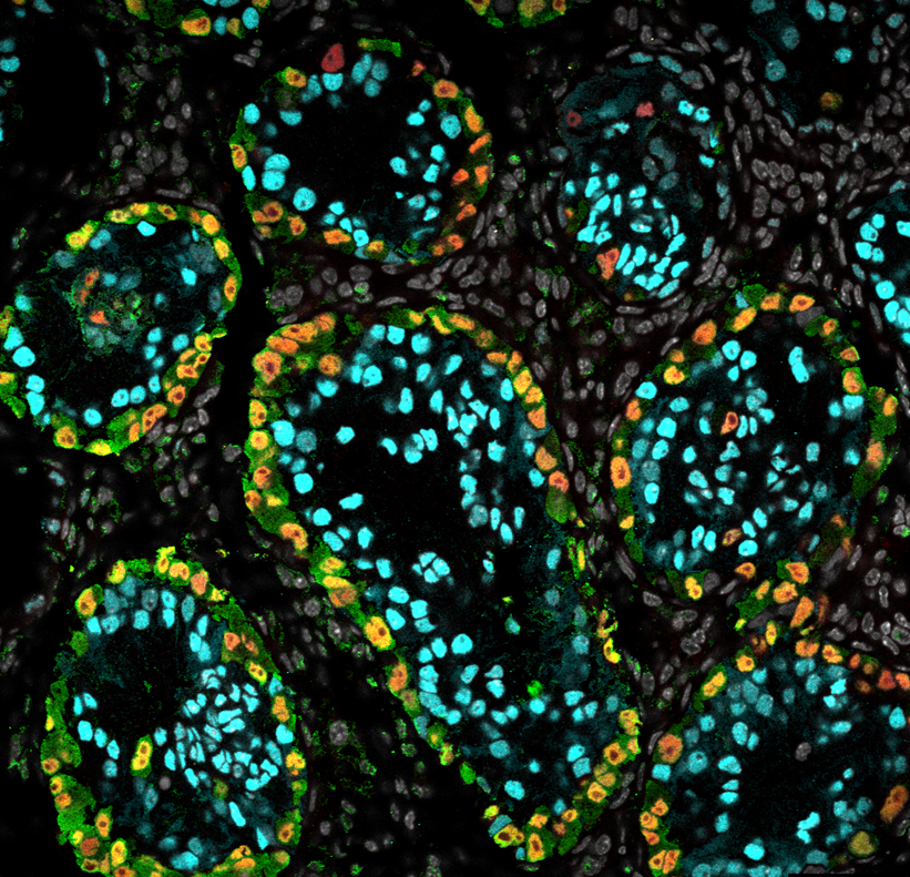 Amsbio: iPSC protocol opens the door to explore male infertility treatments