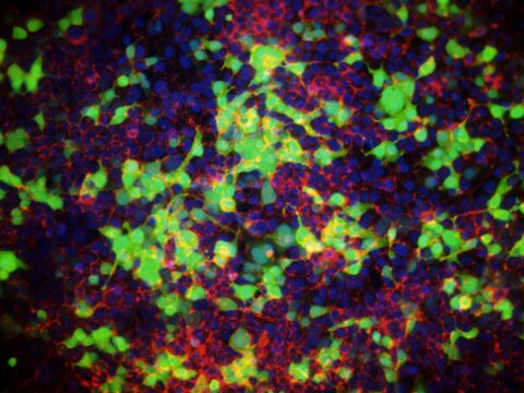 Amsbio: Exceptional transfection reagent for widest range of cell lines