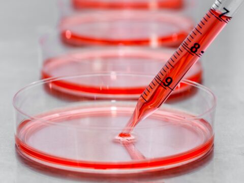 Gentle and rapid detachment of even delicate adherent cells