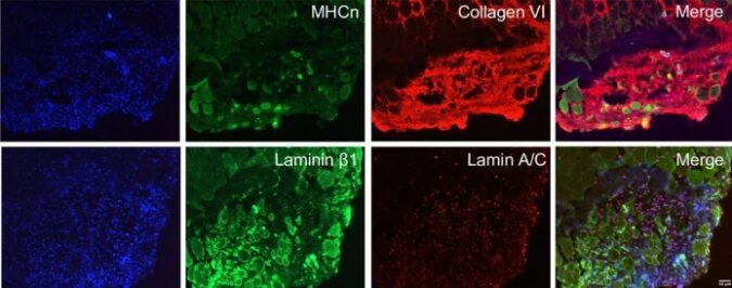 Highly efficient kit yields significant populations of pure myogenic cells