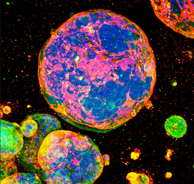 Amsbio: Defined 3D matrix enhances cancer organoid research