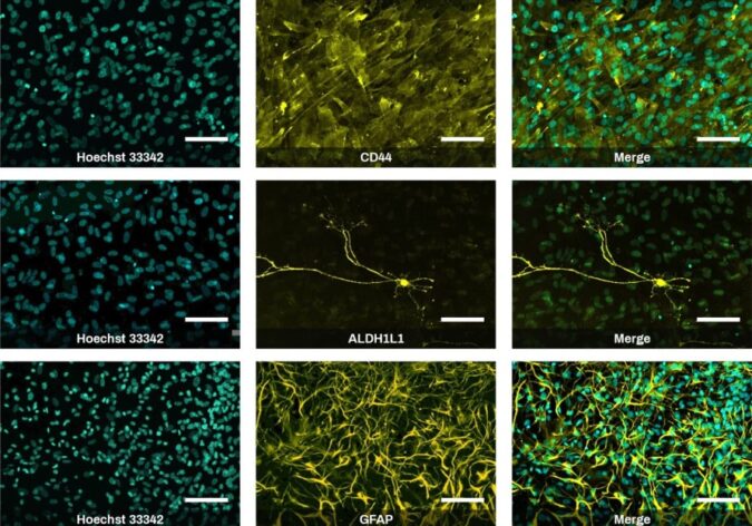 Amsbio: iPSC Differentiation kits for neuroscience research
