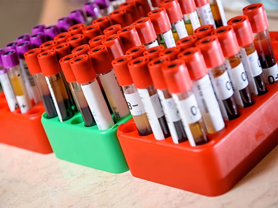 Top quality fresh blood products with next day delivery